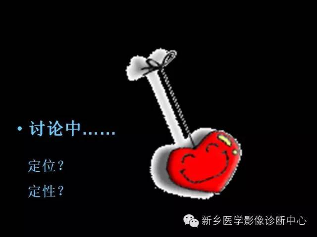 【病例】卵巢颗粒细胞瘤1例MR影像表现与鉴别