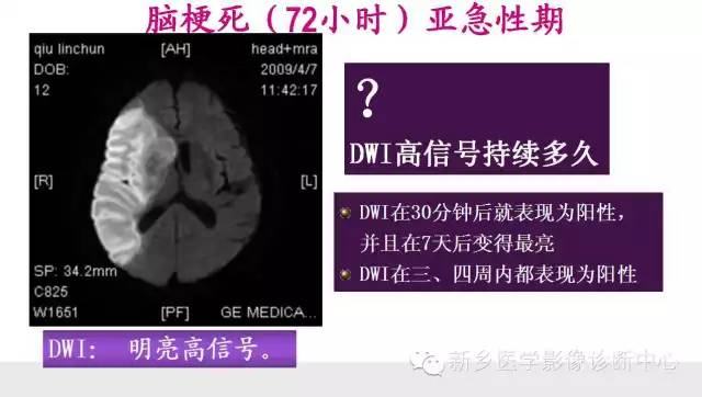 脑梗塞的磁共振分期图解