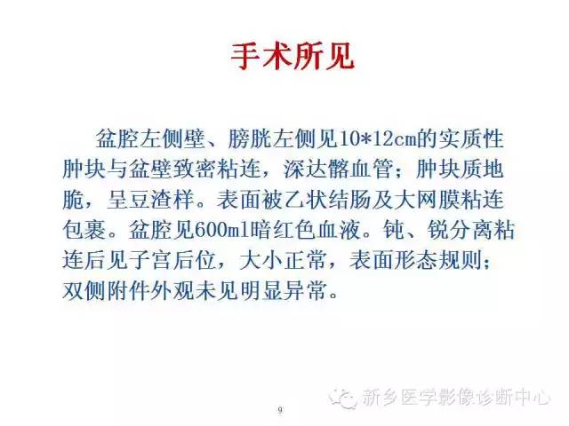 【病例】盆腔胚胎型横纹肌肉瘤1例CT影像表现与鉴别