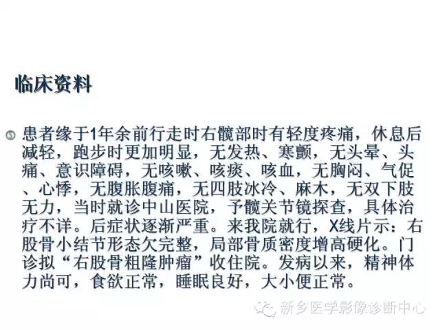 【病例】股骨骨样骨瘤1例影像表现