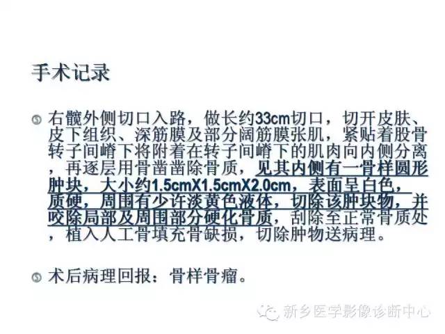【病例】股骨骨样骨瘤1例影像表现