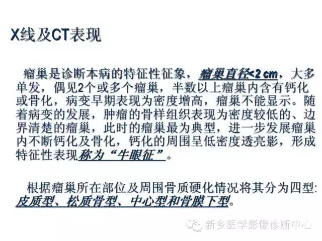 【病例】股骨骨样骨瘤1例影像表现