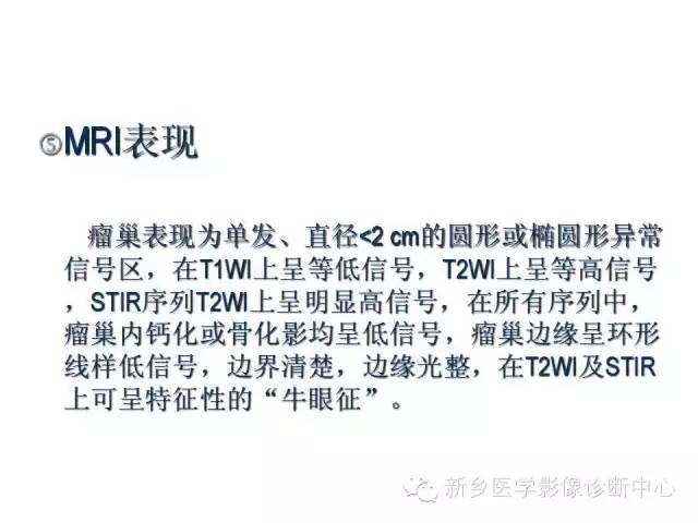 【病例】股骨骨样骨瘤1例影像表现