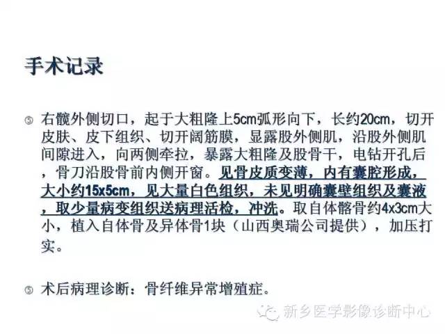 【病例】骨纤维异常增殖症1例MR影像表现