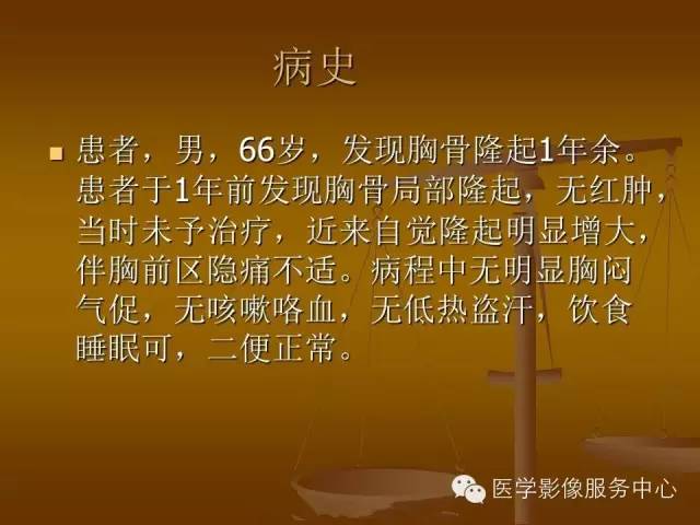 【病例】胸骨浆细胞骨髓瘤1例CT影像表现
