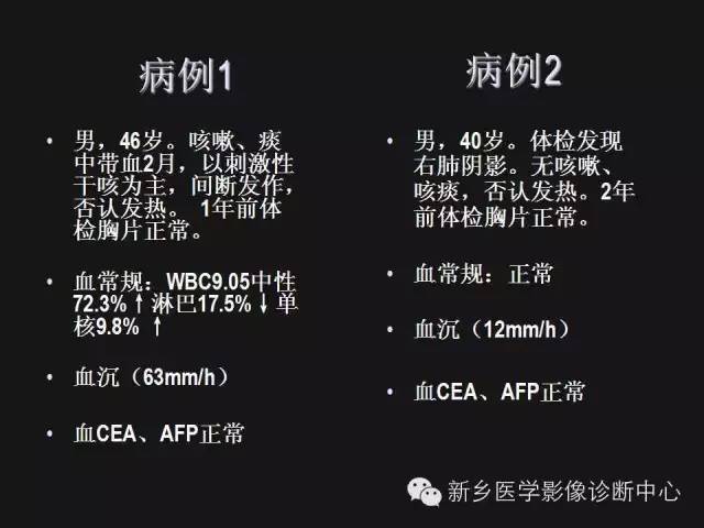 【病例】肺炎性假瘤2例影像表现与鉴别