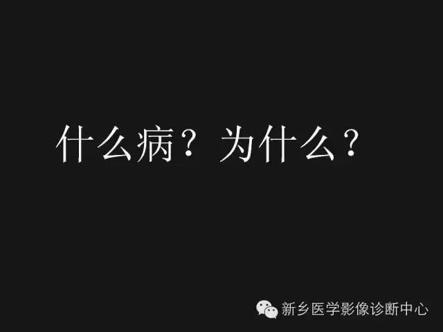 【病例】肺炎性假瘤2例影像表现与鉴别