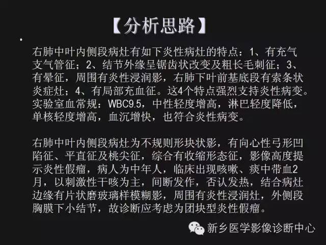 【病例】肺炎性假瘤2例影像表现与鉴别
