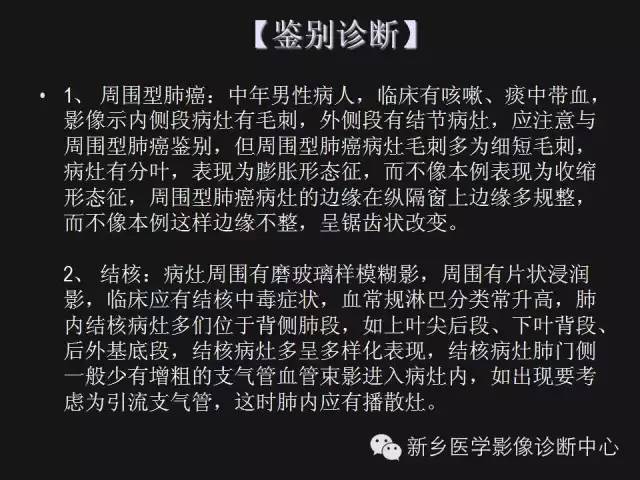 【病例】肺炎性假瘤2例影像表现与鉴别