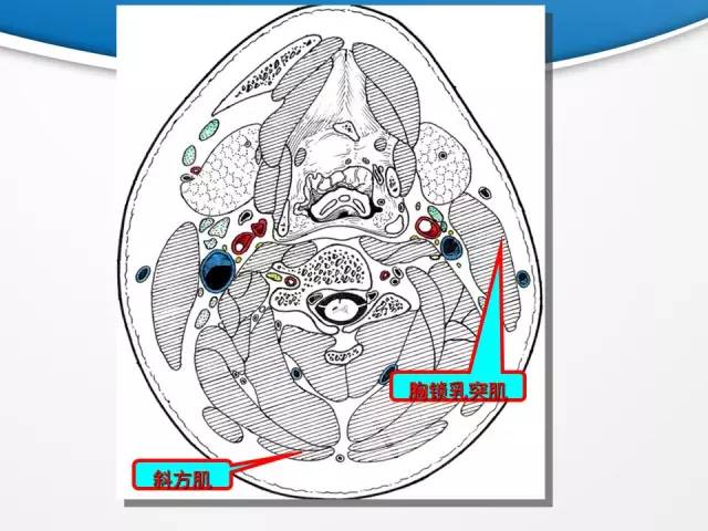 【PPT】颈部淋巴结分区