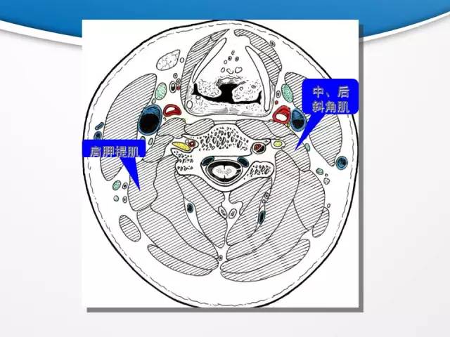 【PPT】颈部淋巴结分区