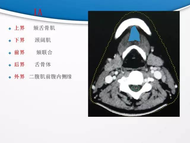 【PPT】颈部淋巴结分区