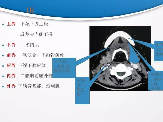 【PPT】颈部淋巴结分区
