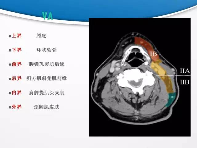 【PPT】颈部淋巴结分区