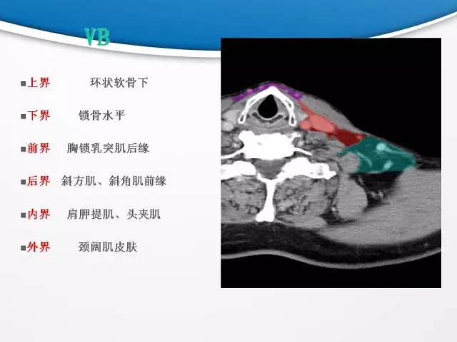 【PPT】颈部淋巴结分区