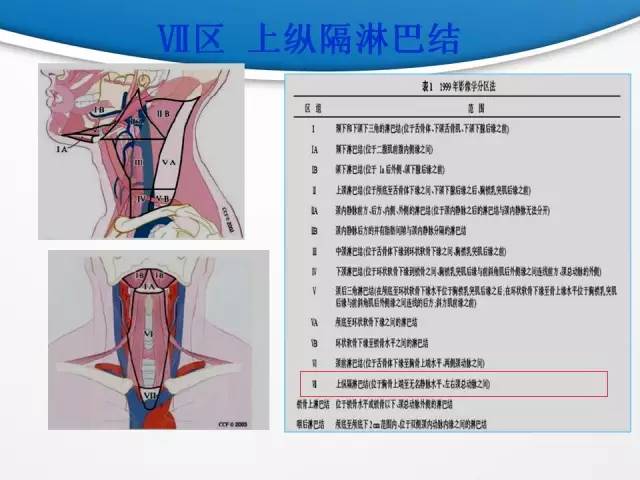 【PPT】颈部淋巴结分区