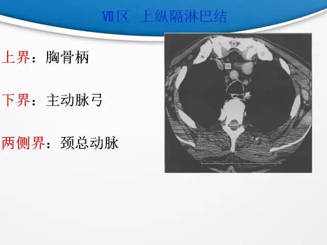 【PPT】颈部淋巴结分区