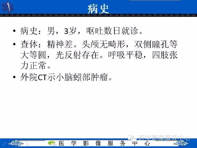 【病例】室管膜母细胞瘤1例MR影像表现