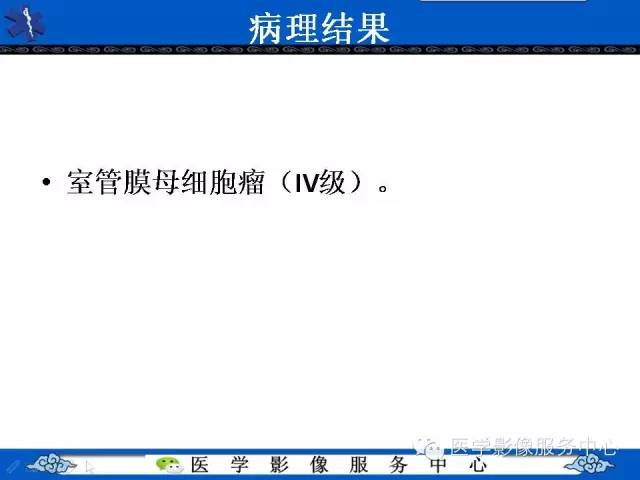 【病例】室管膜母细胞瘤1例MR影像表现