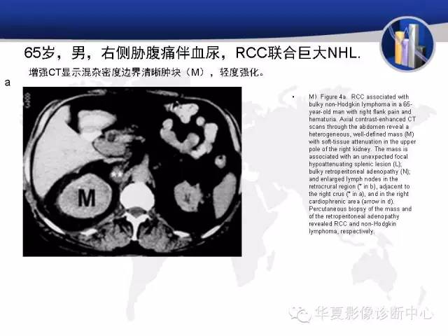 【PPT】RCC罕见影像表现