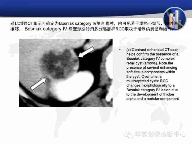 【PPT】RCC罕见影像表现