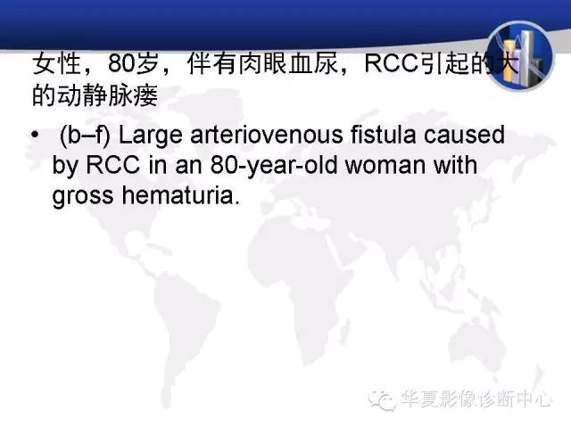 【PPT】RCC罕见影像表现