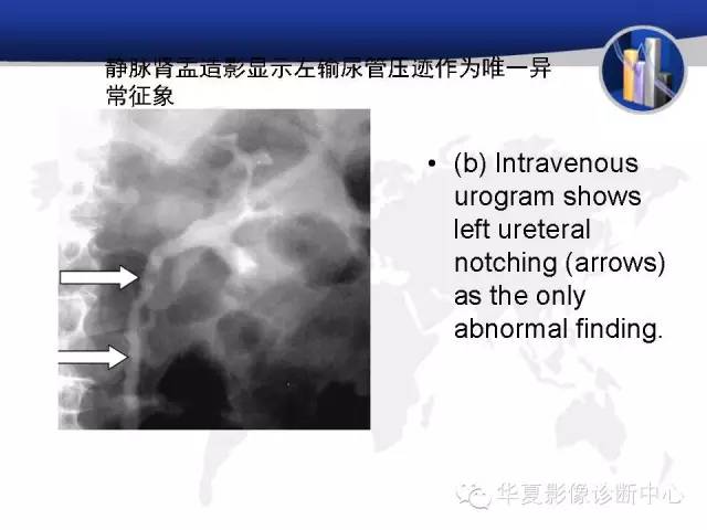 【PPT】RCC罕见影像表现