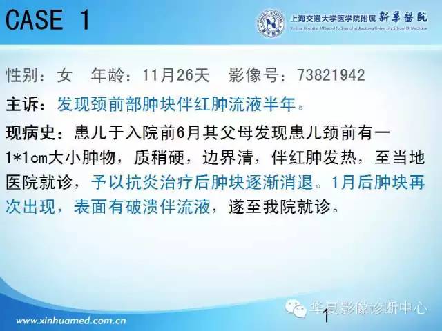【PPT】颈部常见病变影像学诊断与鉴别