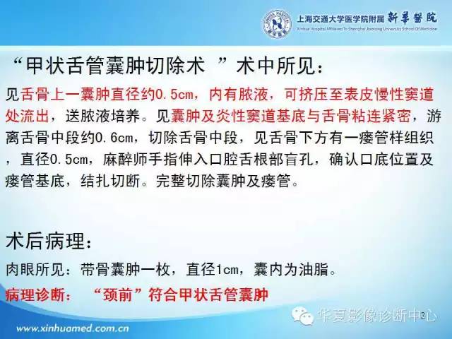 【PPT】颈部常见病变影像学诊断与鉴别