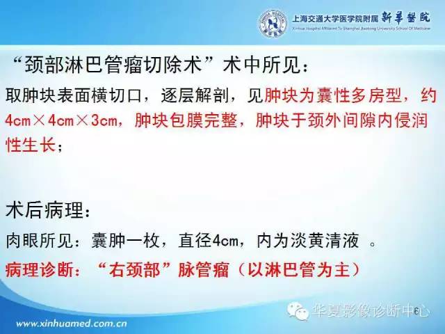 【PPT】颈部常见病变影像学诊断与鉴别