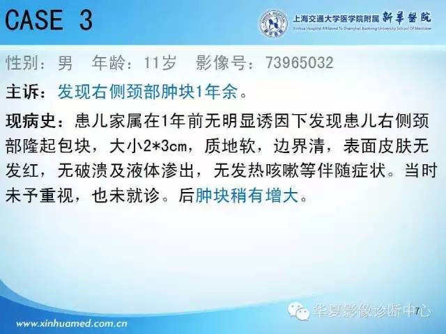 【PPT】颈部常见病变影像学诊断与鉴别