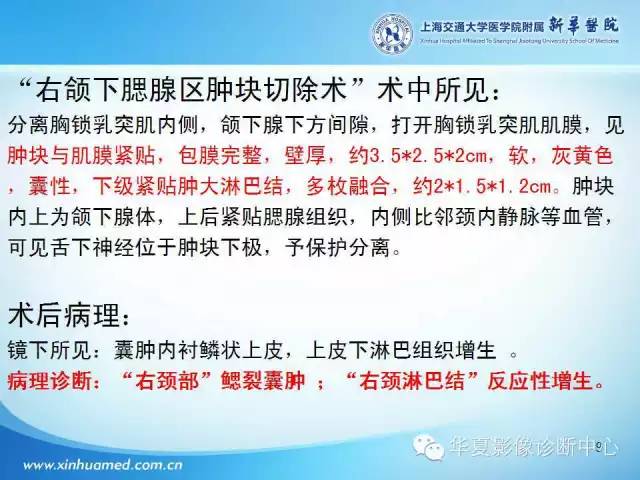 【PPT】颈部常见病变影像学诊断与鉴别