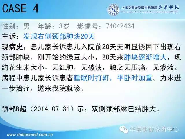 【PPT】颈部常见病变影像学诊断与鉴别