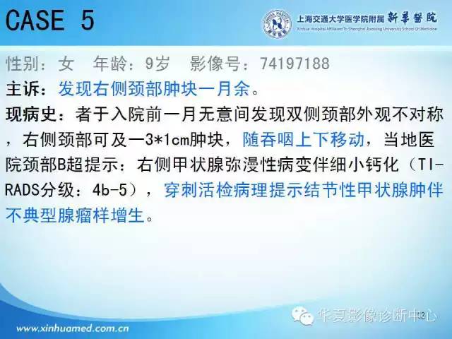 【PPT】颈部常见病变影像学诊断与鉴别
