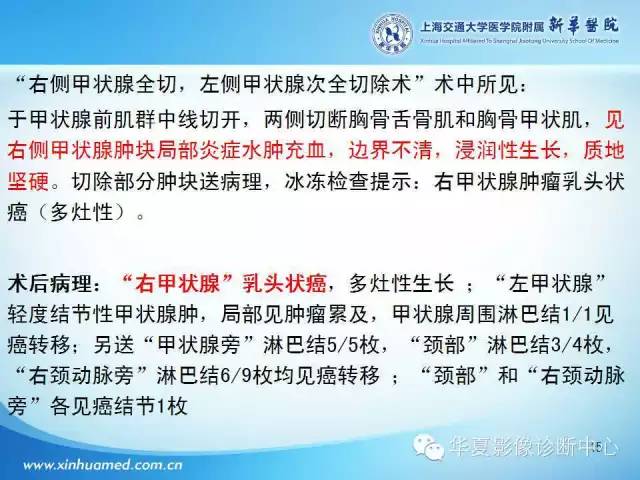 【PPT】颈部常见病变影像学诊断与鉴别