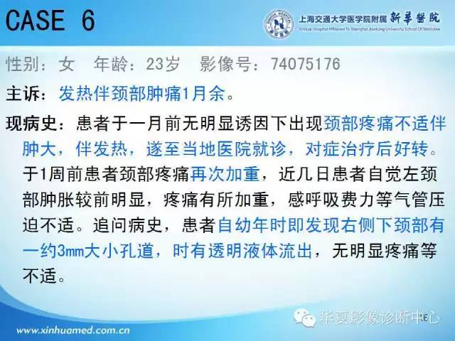 【PPT】颈部常见病变影像学诊断与鉴别