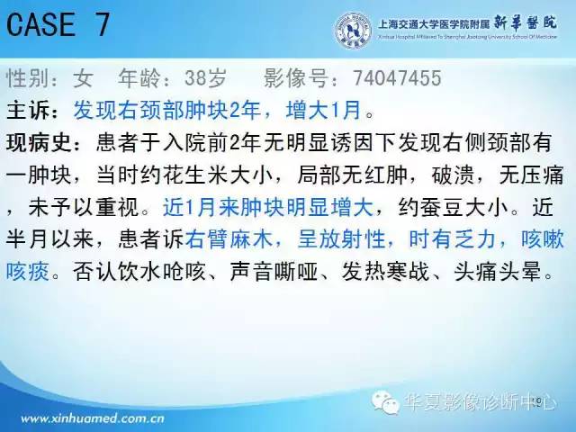 【PPT】颈部常见病变影像学诊断与鉴别