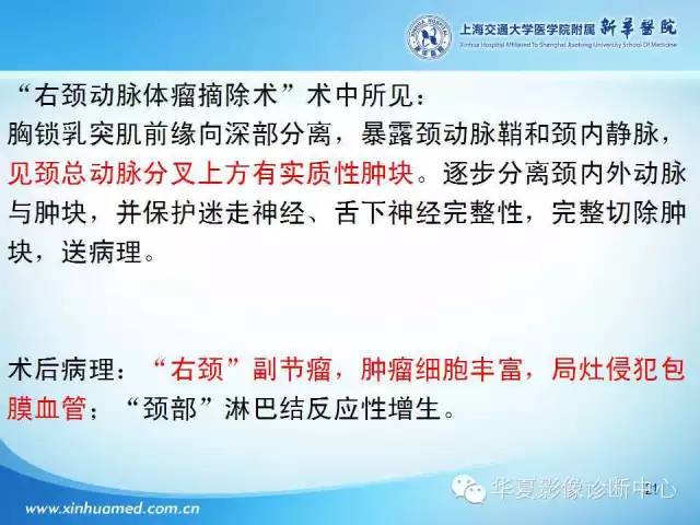 【PPT】颈部常见病变影像学诊断与鉴别