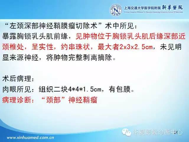 【PPT】颈部常见病变影像学诊断与鉴别
