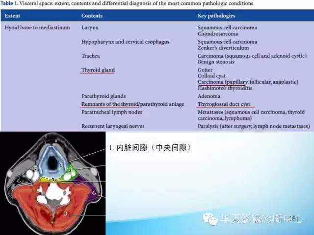 【PPT】颈部常见病变影像学诊断与鉴别