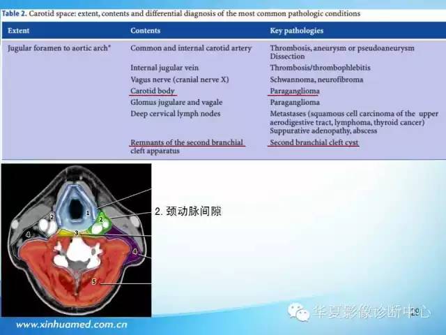 【PPT】颈部常见病变影像学诊断与鉴别