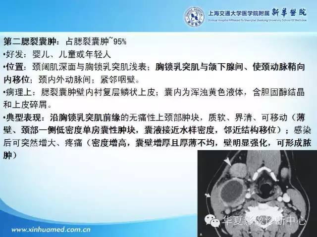 【PPT】颈部常见病变影像学诊断与鉴别