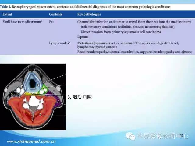 【PPT】颈部常见病变影像学诊断与鉴别