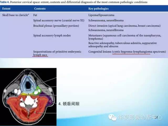 【PPT】颈部常见病变影像学诊断与鉴别