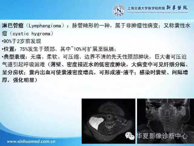 【PPT】颈部常见病变影像学诊断与鉴别