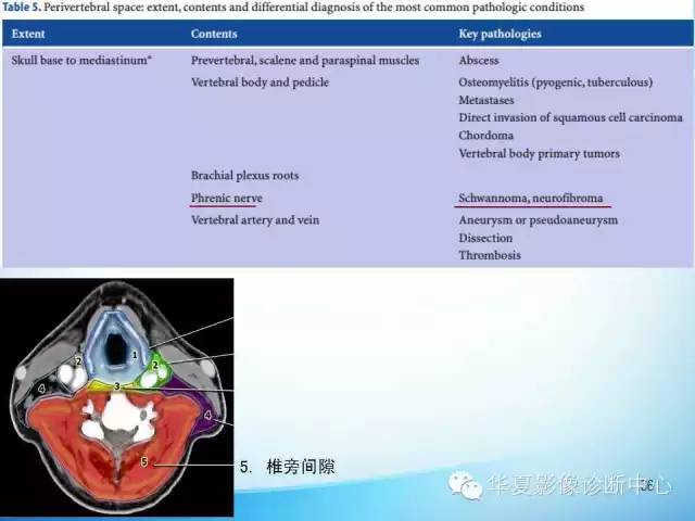 【PPT】颈部常见病变影像学诊断与鉴别