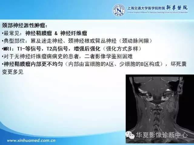 【PPT】颈部常见病变影像学诊断与鉴别