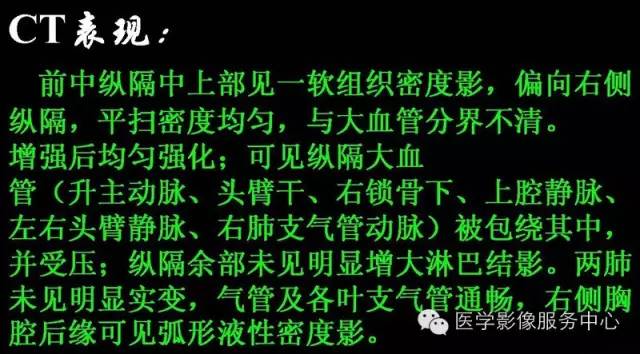 【病例】纵隔淋巴瘤1例CT影像表现