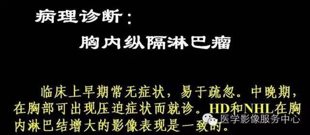 【病例】纵隔淋巴瘤1例CT影像表现