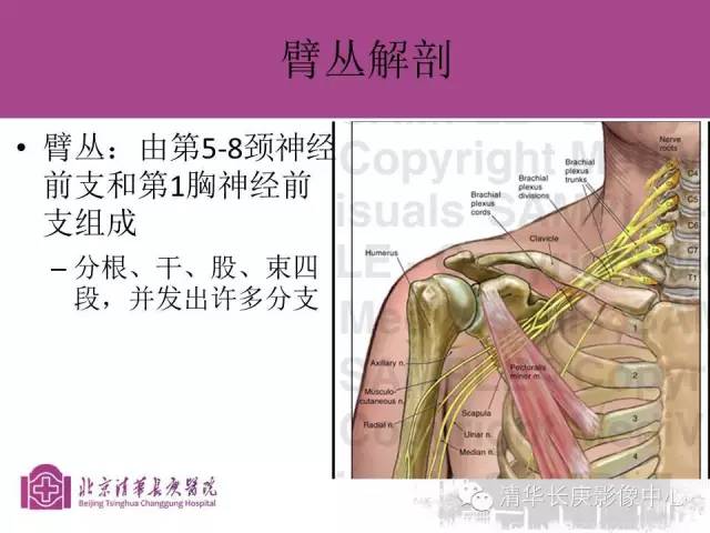 【PPT】臂丛的MR成像